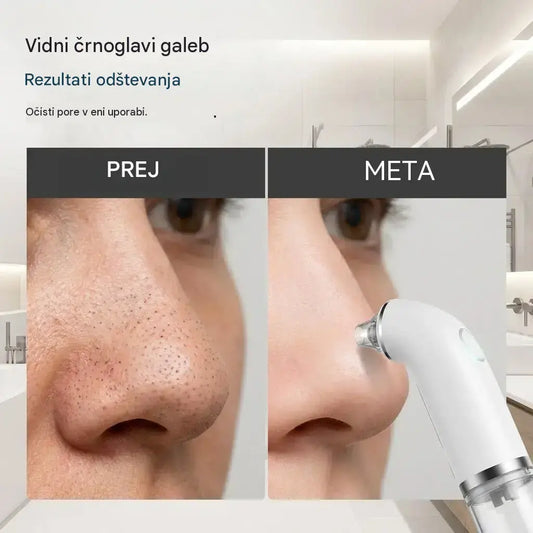 Električni čistilec obraza · Zategovanje in lifting · Globinsko čiščenje por